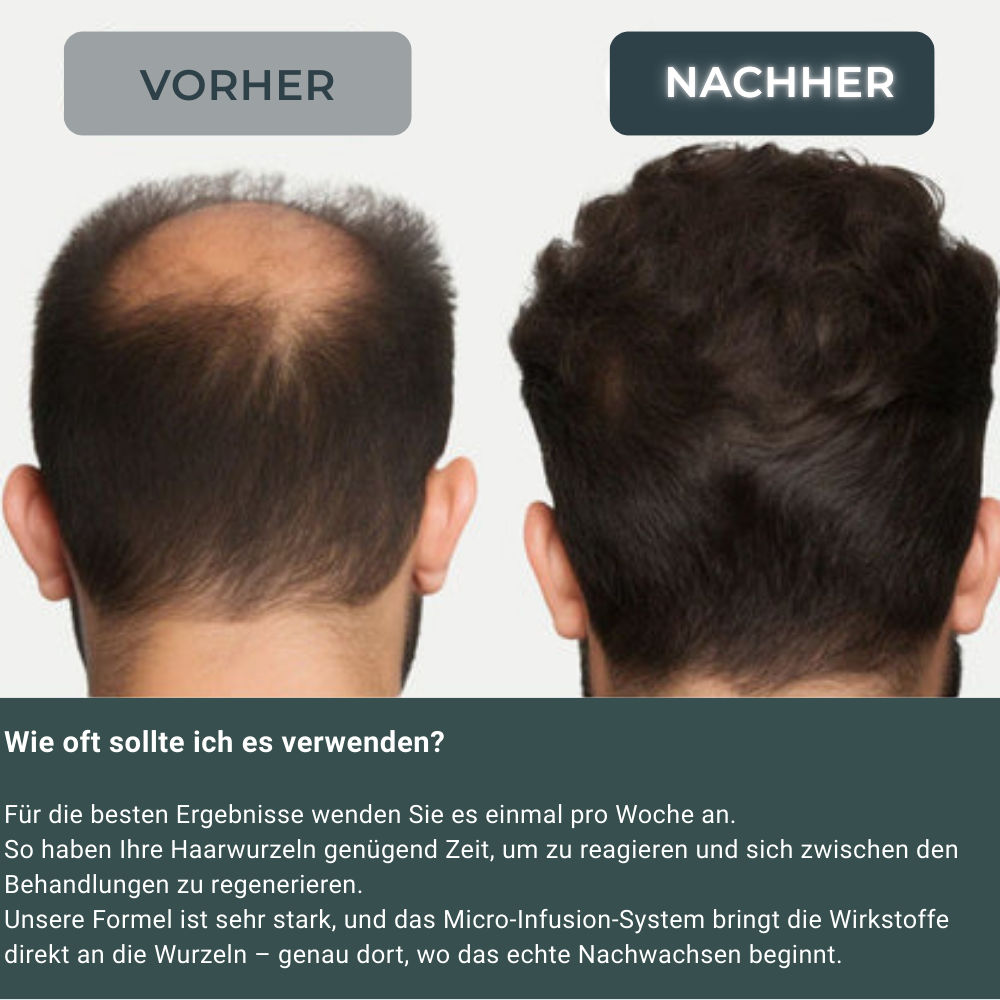 Rehair - regenerative infuse